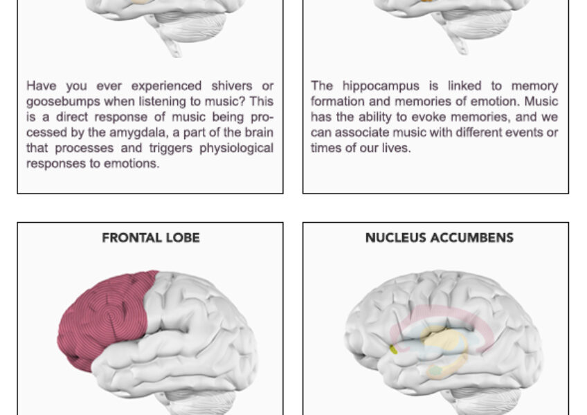Brain-Parts-Music